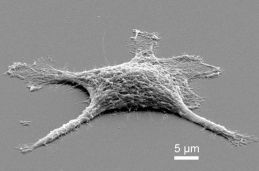 The cells are coated in silicic acid and it 'embalms' the living cell and can survive greater temperatures than flesh